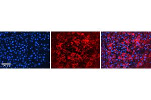 Rabbit Anti-ATP1B1 Antibody   Formalin Fixed Paraffin Embedded Tissue: Human Liver Tissue Observed Staining: Plasma membrane and cytoplasm in hepatocytes Primary Antibody Concentration: 1:100 Other Working Concentrations: N/A Secondary Antibody: Donkey anti-Rabbit-Cy3 Secondary Antibody Concentration: 1:200 Magnification: 20X Exposure Time: 0. (ATP1B1 antibody  (C-Term))