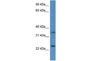 Mouse Thymus; WB Suggested Anti-Cyb5r1 Antibody. (CYB5R1 antibody  (N-Term))