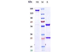 Anti-IL-4Ra / CD124 Reference Antibody (dupilumab) on SDS-PAGE under reducing (R) condition. (Recombinant IL-4RA (Dupilumab Biosimilar) antibody)