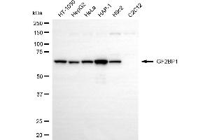 Western blotting analysis using IGF2BP1 antibody (ABIN7799050).