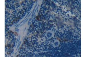 DAB staining on IHC-P; Samples: Mouse Spleen Tissue (BOC antibody  (AA 668-866))