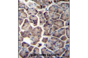 WDR12 Antibody (Center) (ABIN657000 and ABIN2846179) immunohistochemistry analysis in formalin fixed and paraffin embedded human pancreas tissue followed by peroxidase conjugation of the secondary antibody and DAB staining. (WDR12 antibody  (AA 210-239))