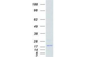 Validation with Western Blot (Hemoglobin Subunit beta Protein (Myc-DYKDDDDK Tag))