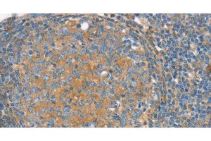 Immunohistochemistry of paraffin-embedded Human tonsil using SNX3 Polyclonal Antibody at dilution of 1:30