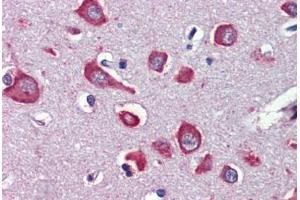 Human Brain, Cortex (formalin-fixed, paraffin-embedded) stained with CHRNA7 antibody ABIN462402 followed by biotinylated secondary antibody, alkaline phosphatase-streptavidin and chromogen. (CHRNA7 antibody)