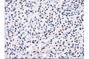Immunohistochemical staining of paraffin-embedded liver tissue using anti-AKR1A1mouse monoclonal antibody. (AKR1A1 antibody)