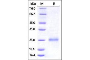 Human CD99, His Tag on SDS-PAGE under reducing (R) condition.
