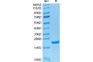 Human CD20 on Tris-Bis PAGE under reduced condition. (CD20 Protein (AA 141-188) (His-Avi Tag))