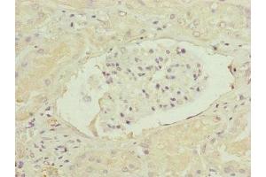 Immunohistochemistry of paraffin-embedded human kidney tissue using ABIN7152447 at dilution of 1:100 (FBXO6 antibody  (AA 104-293))