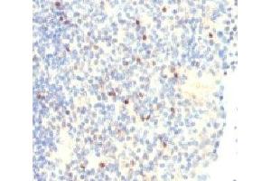 IHC analysis of FOXP3 antibody and human tonsil tissue. (FOXP3 antibody  (N-Term))