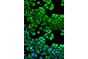 Immunofluorescence analysis of A549 cell using NLRC4 antibody. (NLRC4 antibody)