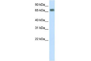 WB Suggested Anti-ZFP64 Antibody Titration:  2. (ZFP64 antibody  (N-Term))