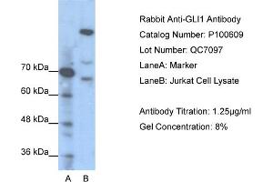 WB Suggested Anti-GLI1  Antibody Titration: 1. (GLI1 antibody  (N-Term))