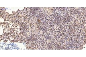 Immunohistochemistry of paraffin-embedded Mouse lung tissue using CD10 Monoclonal Antibody at dilution of 1:200. (MME antibody)