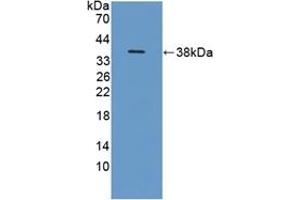 Detection of Recombinant ITIH1, Human using Polyclonal Antibody to Inter Alpha-Globulin Inhibitor H1 (ITIH1) (ITIH1 antibody  (AA 507-819))