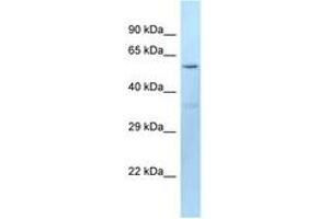 Image no. 1 for anti-Dopachrome Tautomerase (DCT) (AA 41-90) antibody (ABIN6747923) (DCT antibody  (AA 41-90))