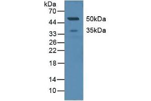 Figure. (C-Type Lectin Domain Family 4, Member M (CLEC4M) (AA 242-399) antibody)