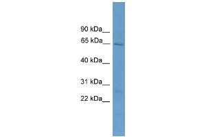 WB Suggested Anti-ACOT11 Antibody Titration: 0. (ACOT11 antibody  (Middle Region))