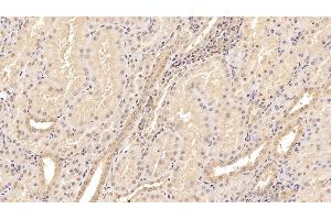 Detection of TNC in Human Kidney Tissue using Monoclonal Antibody to Tenascin C (TNC) (TNC antibody  (AA 49-181))