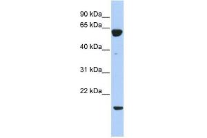 PTP4A3 antibody used at 1 ug/ml to detect target protein. (PTP4A3 antibody  (Middle Region))