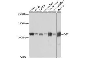Western blot analysis of extracts of various cell lines, using OGT Rabbit mAb (ABIN7269074) at 1:1000 dilution. (OGT antibody)