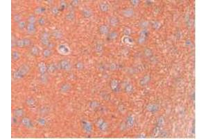 IHC-P analysis of Rat Brain Tissue, with DAB staining. (SPTAN1 antibody  (AA 2071-2269))