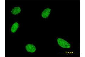 Immunofluorescence of monoclonal antibody to GCM1 on HeLa cell. (GCM1 antibody  (AA 108-166))