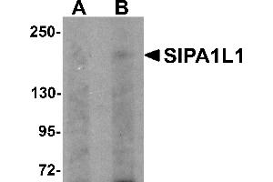 Western Blotting (WB) image for anti-Signal-Induced Proliferation-Associated 1 Like 1 (SIPA1L1) (N-Term) antibody (ABIN1031564) (SIPA1L1 antibody  (N-Term))