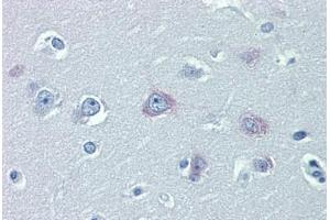 Brain, cortex, Human: Formalin-Fixed, Paraffin-Embedded (FFPE) (TRPM2 antibody  (AA 431-480))