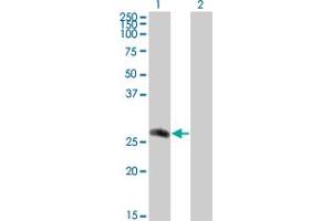 Western Blot analysis of CDC42EP2 expression in transfected 293T cell line by CDC42EP2 monoclonal antibody (M01), clone 2H7.