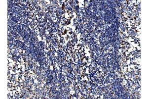IHC analysis of Bim/BCL2L11 using anti-Bim/BCL2L11 antibody (ABIN7602855). (BIM antibody  (C-Term))