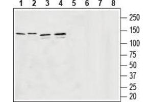 Western blot analysis of rat brain membranes (lanes 1 and 5), mouse brain membranes (lanes 2 and 6), human U-87 MG glyoblastoma lysates (lanes 3 and 7) and human SH-SY5Y brain neuroblastoma lysates (lanes 4 and 8): - 1-4. (SLC32A1 antibody  (Cytosolic, N-Term))