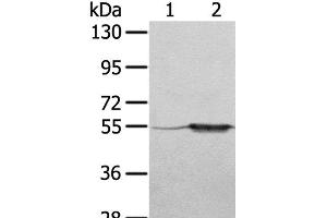 Western Blot analysis of A375 cell and Human fetal muscle tissue using TRIM35 Polyclonal Antibody at dilution of 1:550 (TRIM35 antibody)