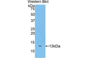 Western Blotting (WB) image for anti-ADAM Metallopeptidase with Thrombospondin Type 1 Motif, 7 (ADAMTS7) (AA 1589-1686) antibody (ABIN3205721) (ADAMTS7 antibody  (AA 1589-1686))