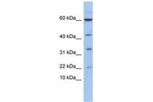 Image no. 1 for anti-LIM Domain Only 2 (Rhombotin-Like 1) (LMO2) (AA 35-84) antibody (ABIN6744411) (LMO2 antibody  (AA 35-84))
