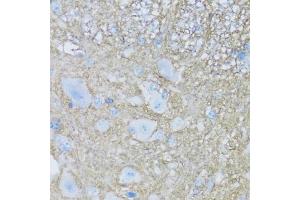 Immunohistochemistry of paraffin-embedded mouse spinal cord using B2 antibody (ABIN7265773) at dilution of 1:100 (40x lens). (ATP1B2 antibody  (AA 68-290))