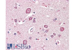 ABIN1019666 (5µg/ml) staining of paraffin embedded Human Cortex. (SDCCAG8 antibody  (Internal Region))