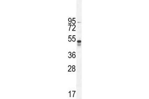 Western Blotting (WB) image for anti-Tumor Necrosis Factor Receptor Superfamily, Member 1A (TNFRSF1A) (AA 252-281) antibody (ABIN3029365)