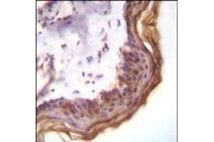 Kallikrein 7(KLK7) Antibody (Center) (ABIN652197 and ABIN2840743) immunohistochemistry analysis in formalin fixed and paraffin embedded human skin tissue followed by peroxidase conjugation of the secondary antibody and DAB staining. (Kallikrein 7 antibody  (AA 67-97))