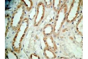 Human kidney tissue was stained by Rabbit Anti-BNP-45 (Mouse) Antibody (BNP-45 antibody  (AA 51-95))
