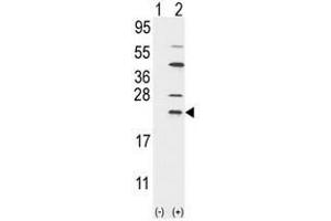 Western blot analysis of UBE2C (arrow) using rabbit polyclonal UBE2C Antibody (UBE2C antibody  (N-Term))