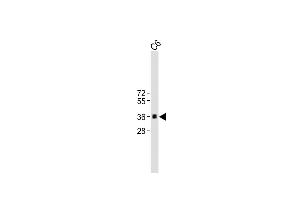 All lanes : Anti-CCND1 at 1:2000 dilution Lane 1: C6 whole cell lysate Lysates/proteins at 20 μg per lane. (Cyclin D1 antibody)