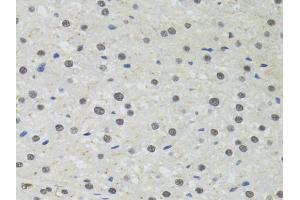 Immunohistochemistry of paraffin-embedded rat liver using PPP4C antibody (ABIN5971135) at dilution of 1/100 (40x lens). (PPP4C antibody)