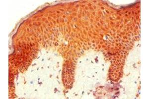 Immunohistochemistry of paraffin-embedded human skin tissue using ABIN7155744 at dilution of 1:100 (HOXB7 antibody  (AA 1-120))