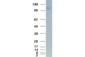 Western Blotting (WB) image for Integrin alpha 4 (ITGA4) protein (Myc-DYKDDDDK Tag) (ABIN2713730)