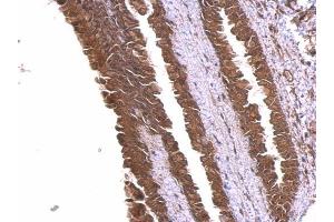 IHC-P Image alpha Adducin antibody detects alpha Adducin protein at membrane and cytosol on mouse esophagus by immunohistochemical analysis. (alpha Adducin antibody)