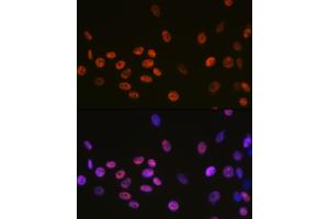 Immunofluorescence analysis of C6 cells using DDX5 Rabbit mAb (ABIN7266698) at dilution of 1:100 (40x lens).