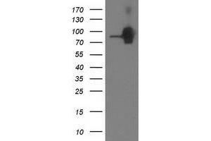 HEK293T cells were transfected with the pCMV6-ENTRY control (Left lane) or pCMV6-ENTRY CTNNB1 (Right lane) cDNA for 48 hrs and lysed. (CTNNB1 antibody)