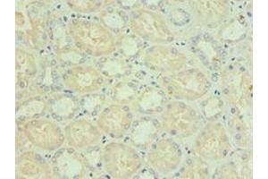 Immunohistochemistry of paraffin-embedded human kidney tissue using ABIN7145332 at dilution of 1:100