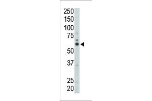 Western Blotting (WB) image for anti-FYN Oncogene Related To SRC, FGR, YES (FYN) (AA 13-43), (N-Term) antibody (ABIN392098)